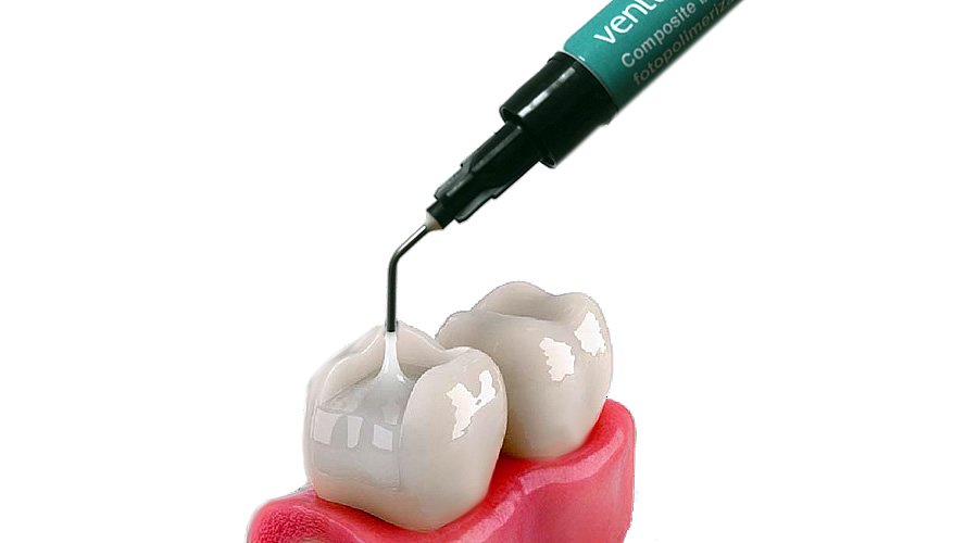 Dental Kompozit Çeşitleri