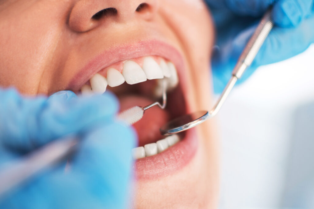 dental artikulasyon kagidi nedir 2